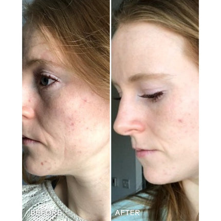 REFRESH PAPAYA + SALICYLIC ACID FOAMING CLEANSER