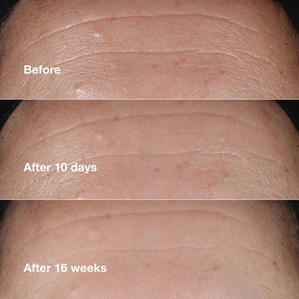 Smart Clinical Repair™ Wrinkle Correcting Serum