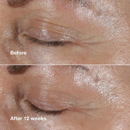 Crème Contour Des Yeux Correctrice De Rides Clinique Smart Clinical Repair™