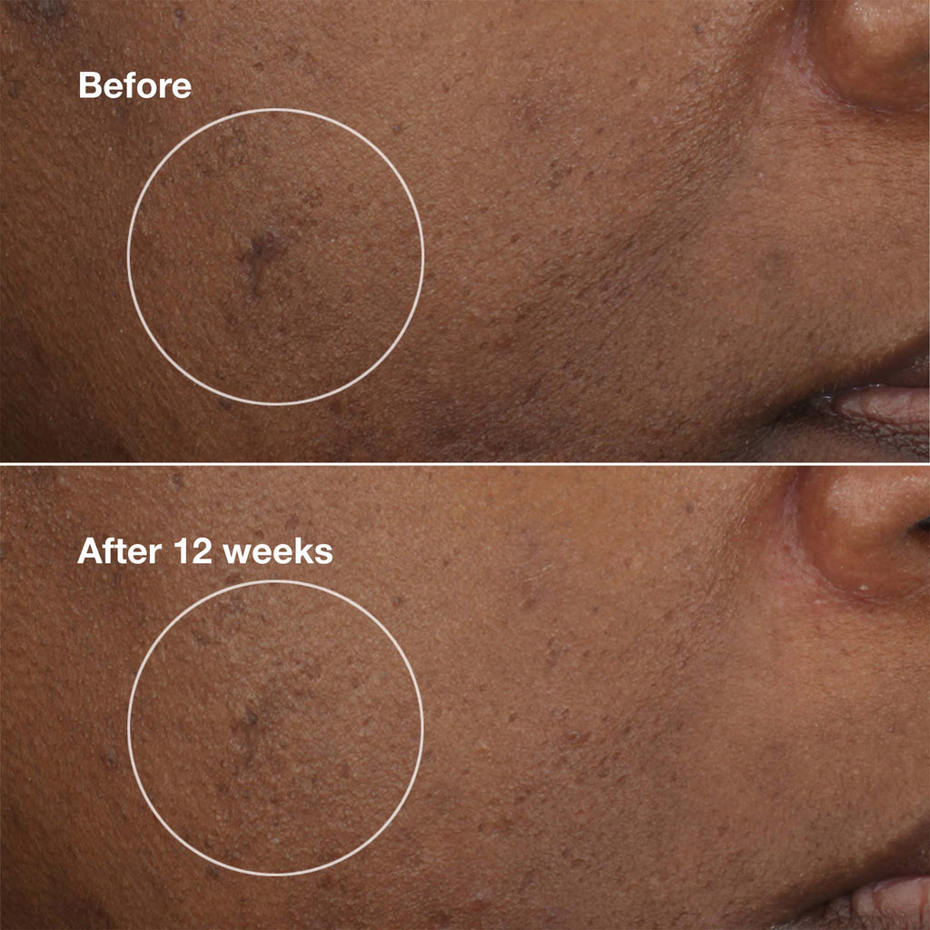 Even Better Eyes™ Soin Éclat Correction Cernes 10 Ml