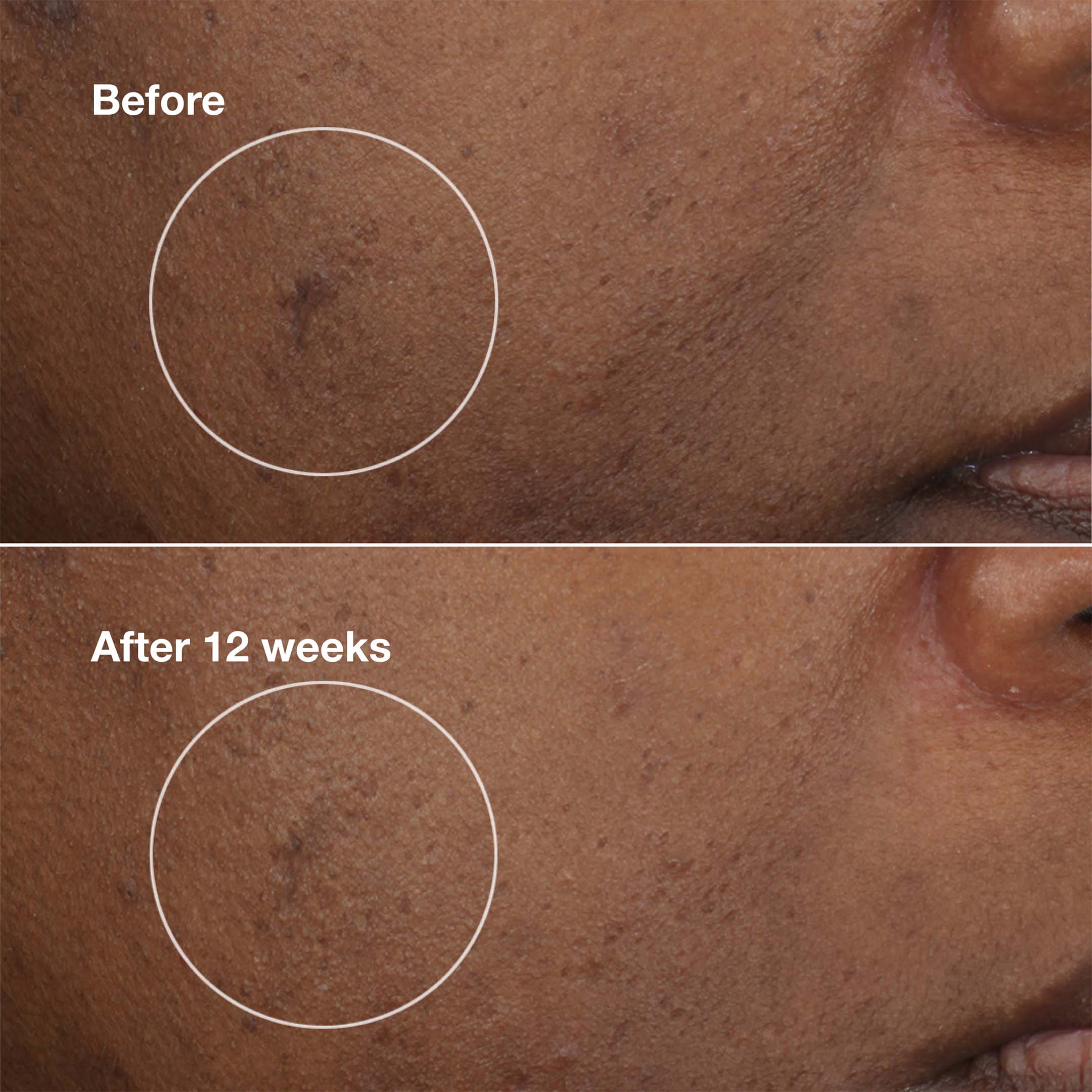 Even Better Eyes™ Soin Éclat Correction Cernes 10 Ml