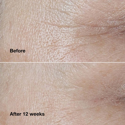 SUPERDEFENSE™ CITY BLOCK™ BROAD SPECTRUM SPF 50 DAILY ENERGY + FACE PROTECTOR 40 ML