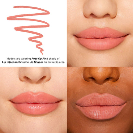 Lip Injection Lip Shaper