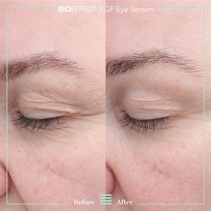 EGF EYE SERUM (6ml)
