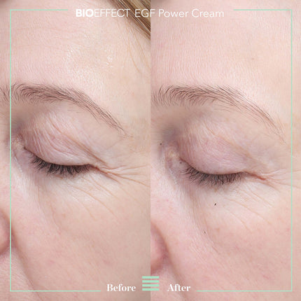 EGF POWER SERUM (15ml)