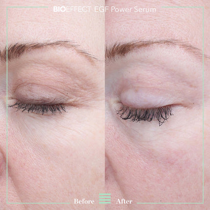 EGF POWER SERUM (15ml)