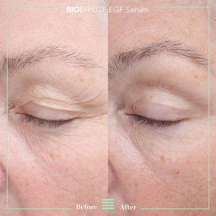 EGF SERUM (15ml)