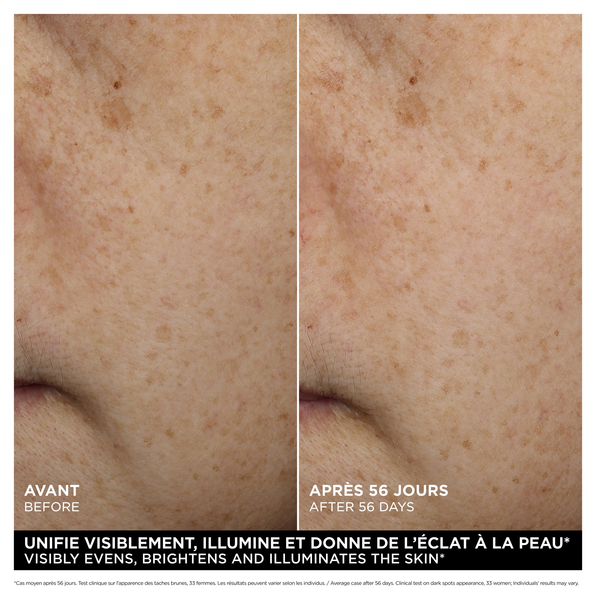 Bright Plus [Advanced] Brightening Milky Emulsion