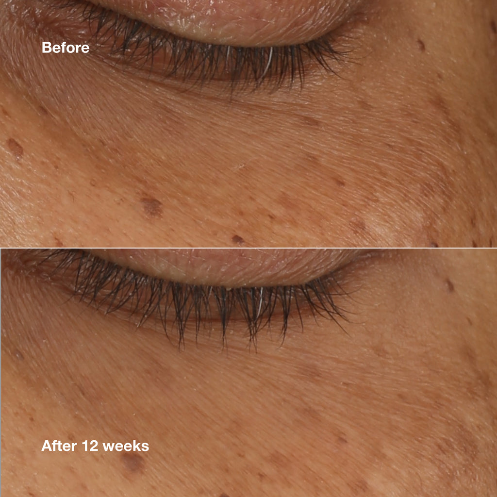 Sérum concentré illuminateur All About Eyes™