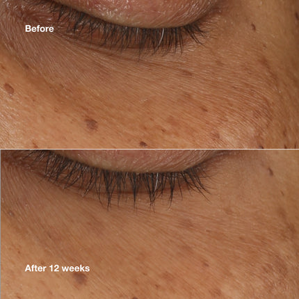 All About Eyes™ Brightening Serum Concentrate
