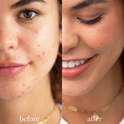 Arnica Correcteur de teint