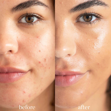 Lychee Crème Corrector