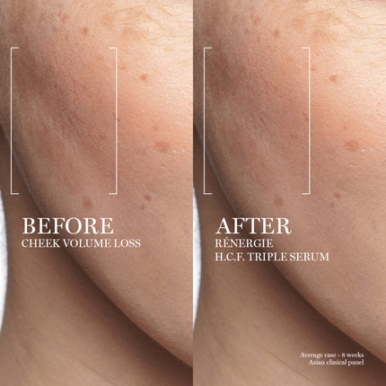 Rénergie H.C.F. Triple Anti-Aging Serum