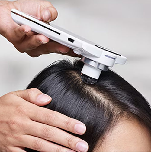 Treat your Scalp - Hair & Scalp Analysis