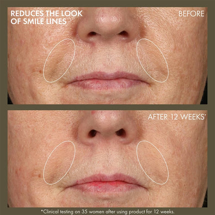 Plantscription™ Active Wrinkle Correction Serum With Retinoid