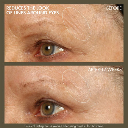 Plantscription™ Active Wrinkle Correction Serum With Retinoid