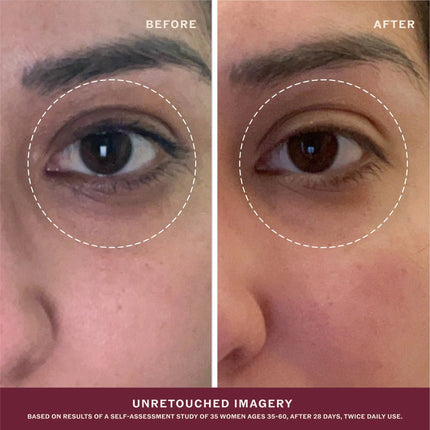 Golden Glow Eye Balm