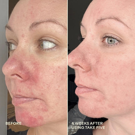 Take Five™ Hypochlorous Acid Balancing Body + Face Spray